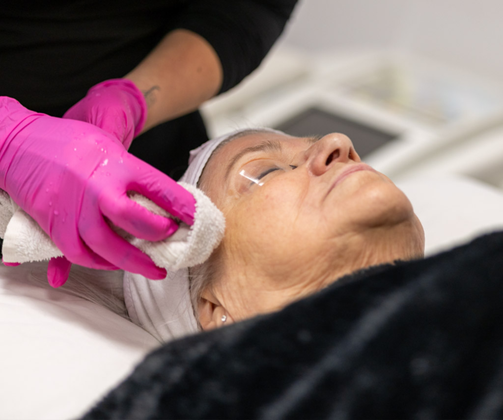 Application d’un soin purifiant sur le visage avec une compresse.