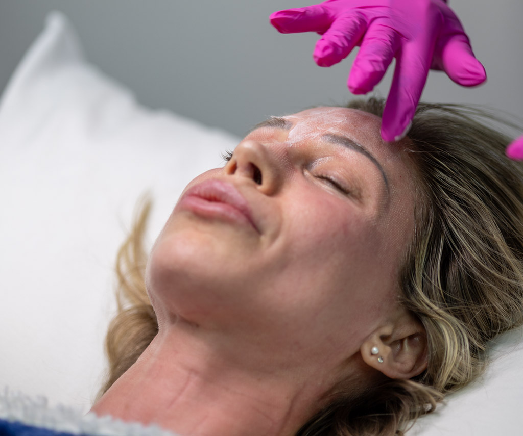 Traitement du visage avec une pièce à main de lumière pulsée.