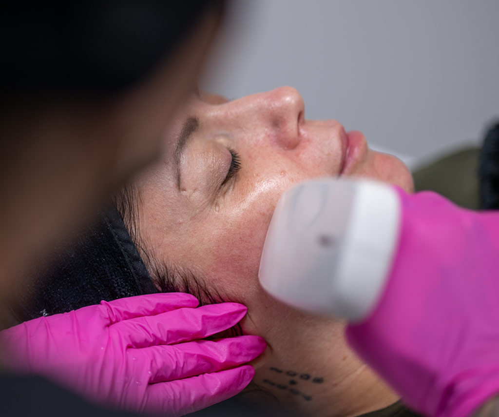 Soin du visage avec une pièce à main de radiofréquence.
